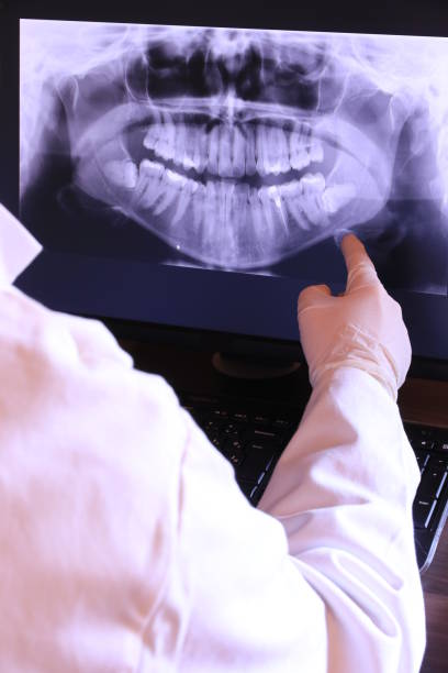 Best Emergency Tooth Extraction in Plum Grove, TX
