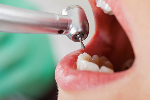 Best Emergency Dental Surgery in Plum Grove, TX